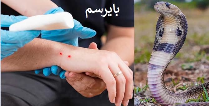 مارها را دور نگه دارید! انتخاب با شماست… لیکوئیدفنس یا TS؟
