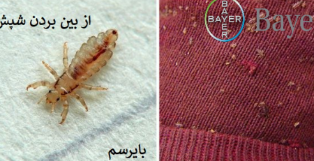 ریشه کنی شپش