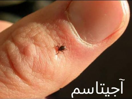 ریشه کنی کنه